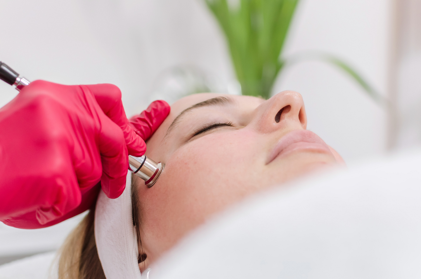 diamond microdermabrasion face treatment